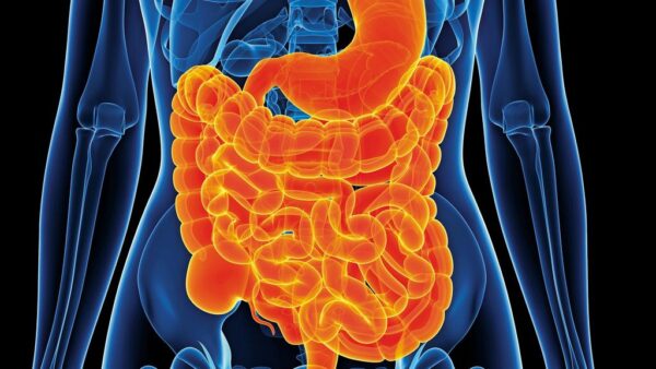 THE IMPACT OF SIBO ON GUT DISORDERS